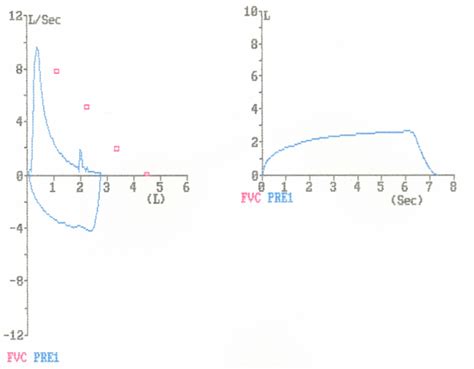 Image result for Pulmonary Function Test Flow Loop