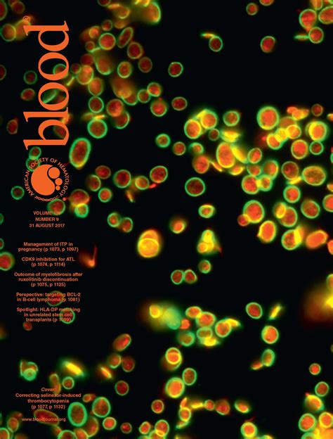 Blood Cover Image に対する画像結果