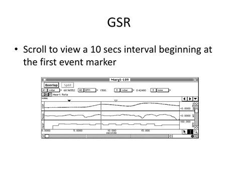 Image result for GSR Module in Polygraph Instrument