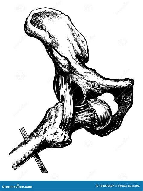 Toradh íomhá ar Dislocation Drawing