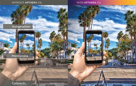 Toradh íomhá ar Multifocal IOL