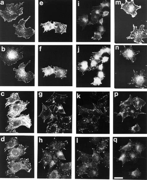 Focal Adhesion If 的图像结果