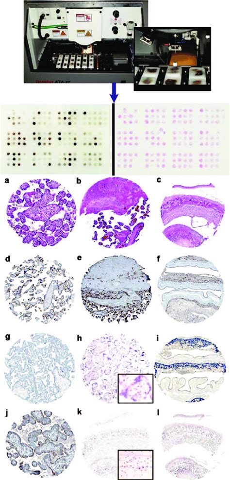 Image result for Tissue Microarray TMA Equipment