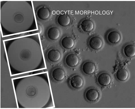 Oocyte Microscope Labeled に対する画像結果
