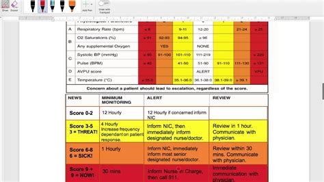 Image result for Neuro Observation Chart