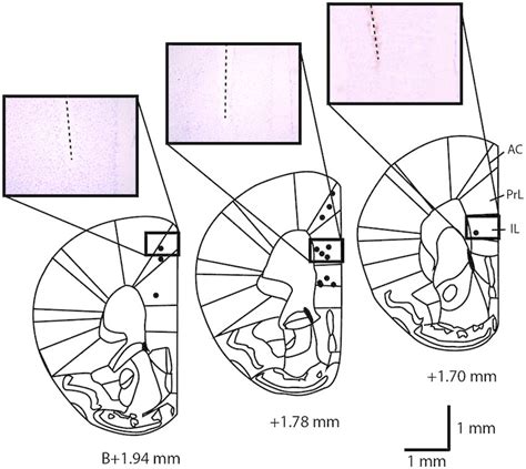 Résultat d’images pour Prefrontal Cortex Mouse Brain