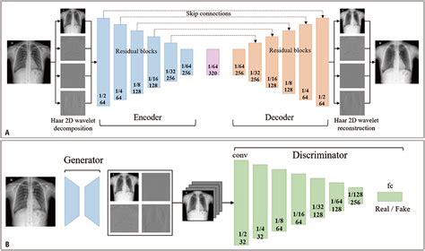Toradh íomhá ar Dual-Energy Subtraction Algorithm