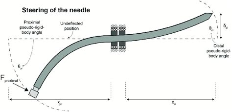Image result for Minimizing Needle Deflection