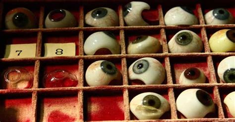 Image result for Eye Pops Out of Socket