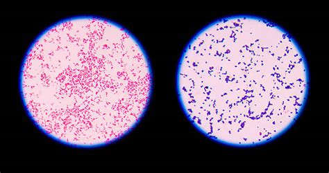 Gram Stain of Streptococcus 的图像结果