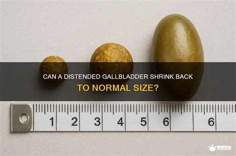 Image result for Back to Normal Size