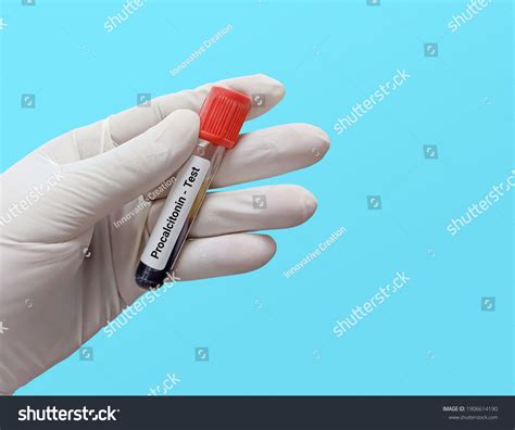 Image result for PCT Test