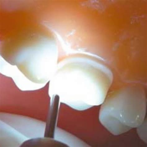 Image result for NSK Nlx Nano