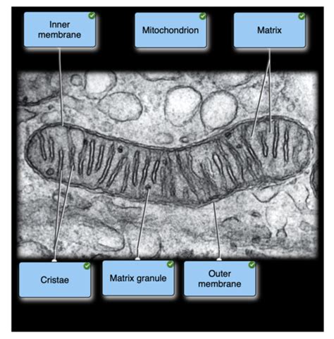 Electron Micrograph of Spongiocite Labelled Diagram に対する画像結果