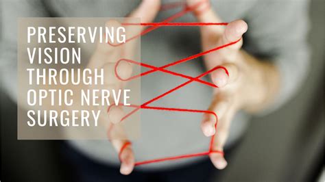 תוצאת תמונה עבור Vision Presevation Tablets