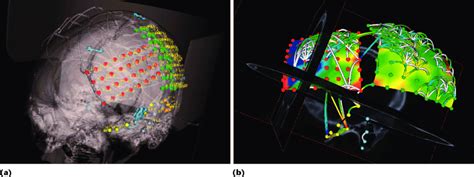 Image result for Python Brain Cavity