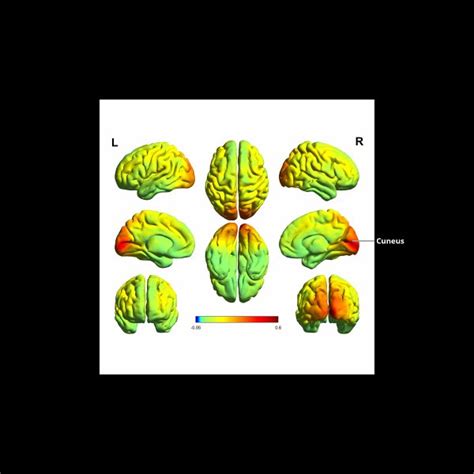 Toradh íomhá ar Visual Cortex Activation Map Surface