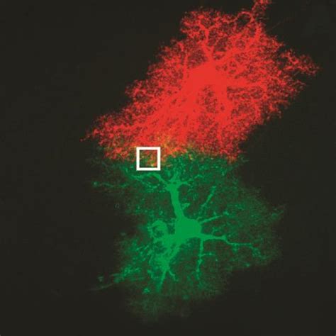 Image result for Electron Microscope Images Color