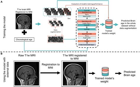 Brain Age Man Name に対する画像結果