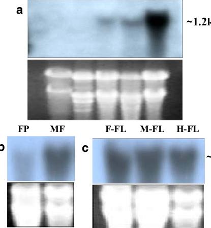 Northern Hybridization に対する画像結果