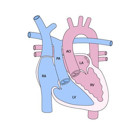 Afbeeldingsresultaten voor Corrected Transposition