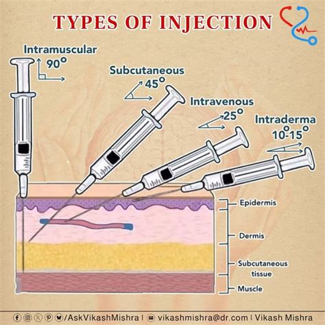 Toradh íomhá ar Pentest+ Injections Diagram