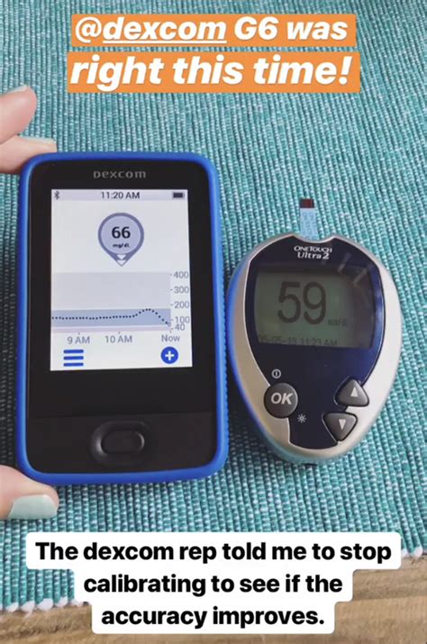 Image result for Dexcom G6 Sample