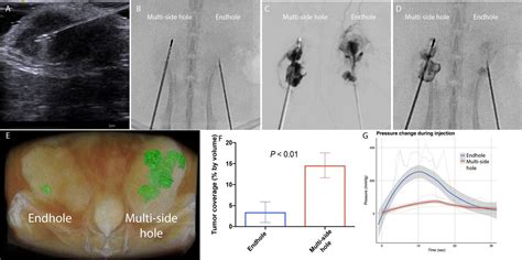 Research Method Injection に対する画像結果