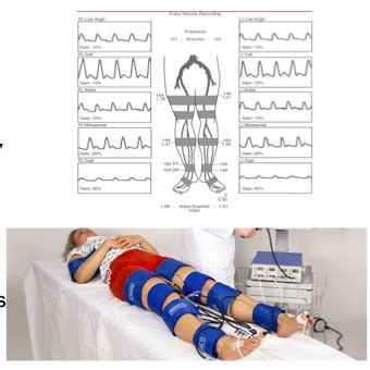 Pressure Gradient Segmental Pressure Lower Extremity に対する画像結果