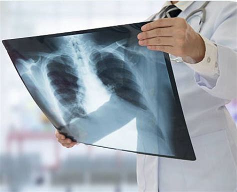 Afbeeldingsresultaten voor Sound X Ray