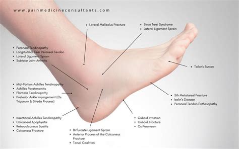 Image result for Foot Pain Types