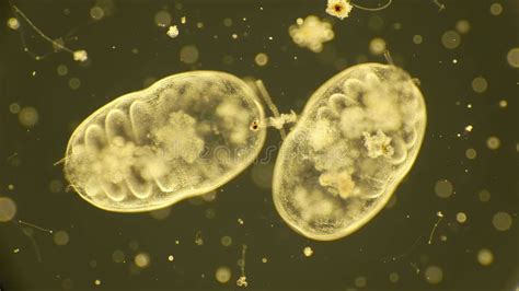 Toradh íomhá ar Digital Microscope Probe for Internal