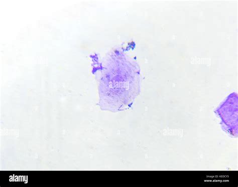 Image result for Human Cheek Cell Microscope