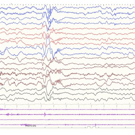 Afbeeldingsresultaten voor Low Frequency Filter Python