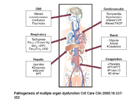 Image result for Multiple Organ Dysfunction Syndrome