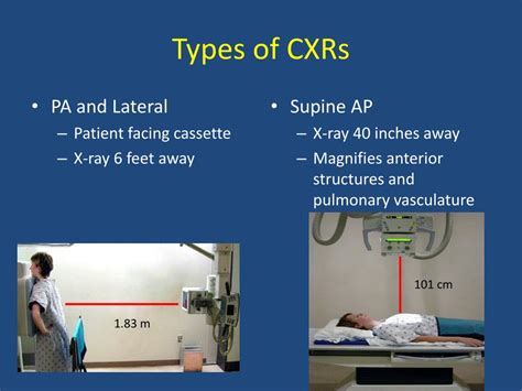 Image result for Infiltrate Base Film