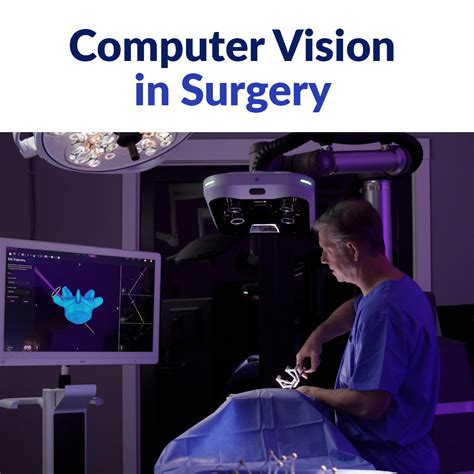 Image result for Computer Vision Neuroendoscopy