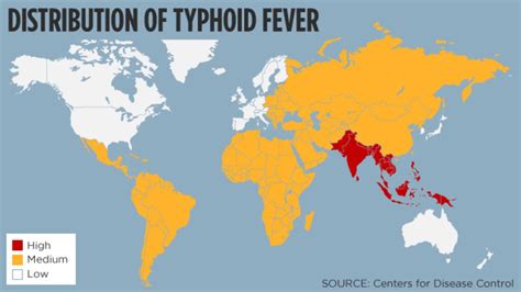 Image result for Typhoid Fever Disease