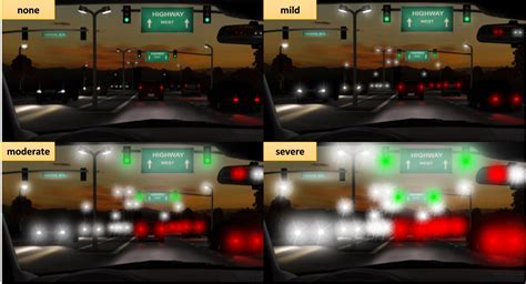 Image result for Multifocal IOL and Color Distortion