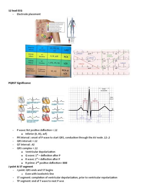 Afbeeldingsresultaten voor ECG Study