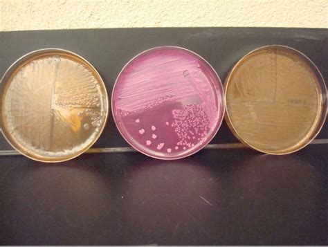 Afbeeldingsresultaten voor MacConkey Agar Gram Positive or Negative