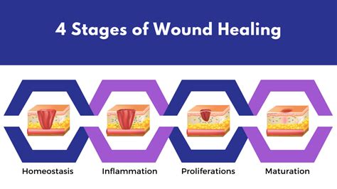 Image result for Wound Maturation Phase Example