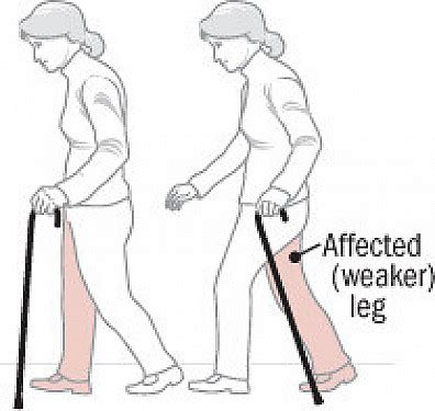 Use a Cane Correctly に対する画像結果