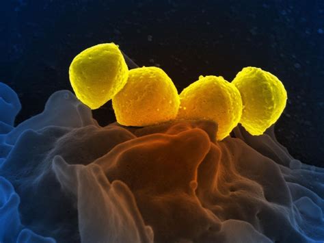 Image result for Scan Electron Microscope