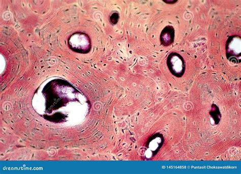 Image result for Compact Bone Micrograph