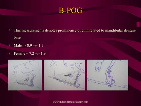 Image result for Perpendicular Cogs