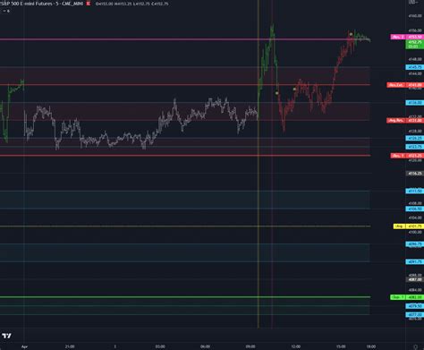 Image result for How to Build Up a Structure Options