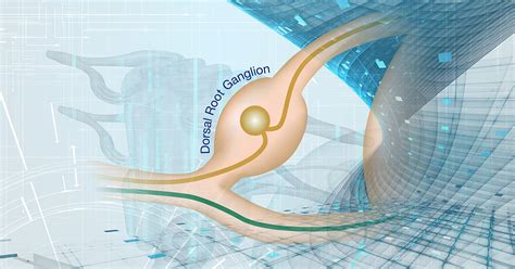 DRG Motoric に対する画像結果