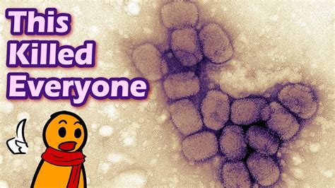 Image result for Smallpox After Effects