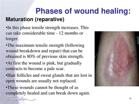 Image result for Wound Maturation Phase Example